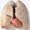 The Worlds Best Lung Detox Program offer Health